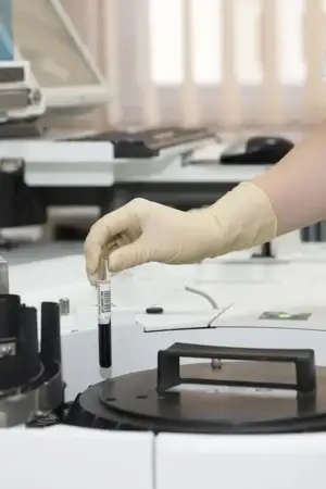 Estudo revela papel de proteínas na saúde celular e na prevenção do envelhecimento